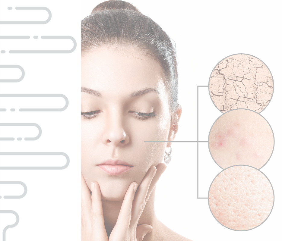 POWER DPL + RF nowa generacja IPL Elight