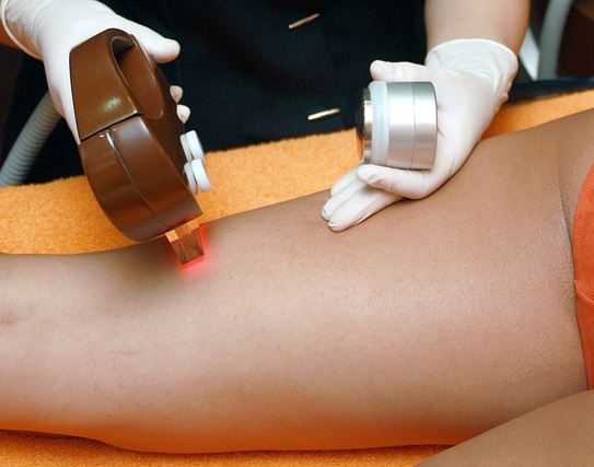 Rodzaje depilacji włosów